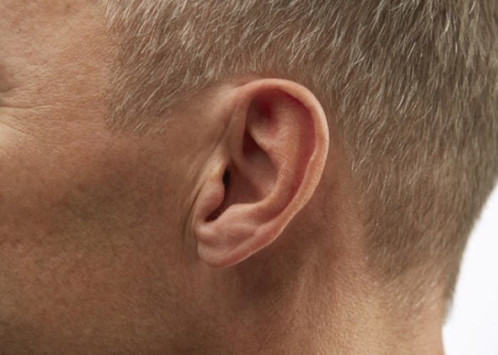 سمعک نامریی - IIC