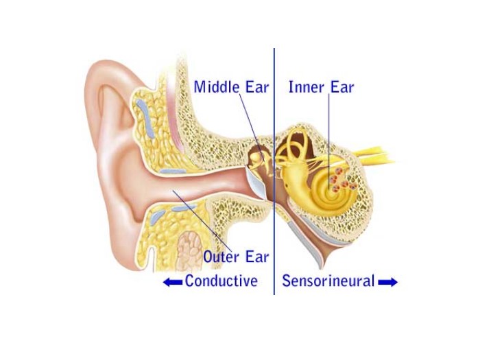 انواع کم شنوایی و علائم کم شنوایی را بشناسید