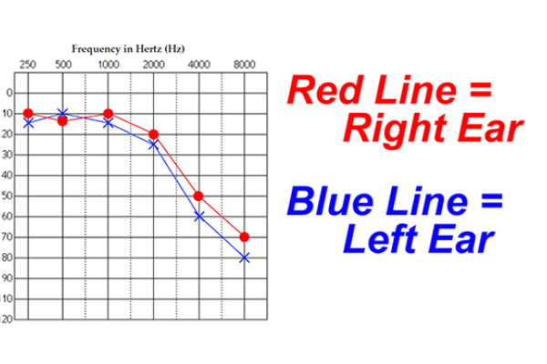 تست های شنوایی سنجی