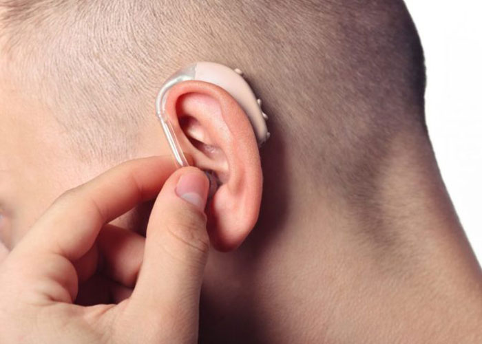 انواع سطح تکنولوژی سمعک را بشناسید