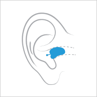 سمعک CIC - کاملا داخل مجرای گوش