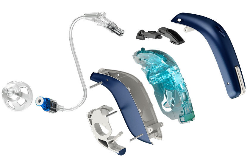 سمعک چیست؟ اجزای تشکیل دهنده سمعک